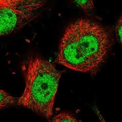 MAML1 Antibody, Novus Biologicals 0.1mL; Unlabeled:Antibodies, Polyclonal
